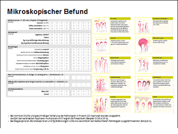 Dr. med. Oliver Sander: Kapillarmikroskopie in der Diagnostik der systemischen Sklerose