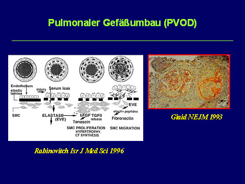 Prof. Dr. med. J. Breuer: Pathophysiologie der PAH im Kindesalter