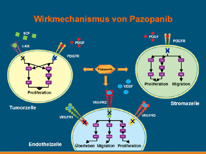 Pazopanib: Ausschuss der EMA befürwortet Zulassung