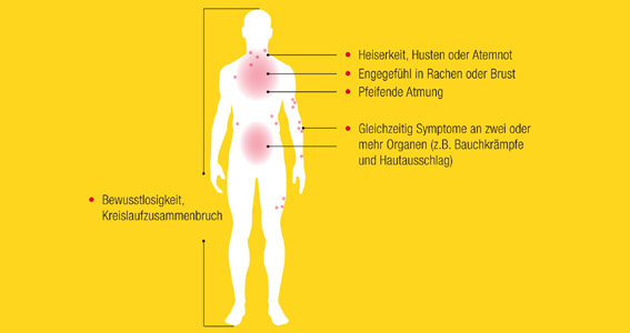 Anaphylaktischer Schock: Im Notfall Mittel der Wahl: Adrenalin-Autoinjektion