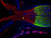 Multiple Sklerose: Neues Behandlungskonzept schützt Nervenzellen