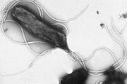 Gastroenterologie: Unerwünschte Mitbewohner im Magen – Die Geschichte des Helicobacter pylori.