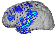 Brain-to-Text: Spracherkennung aus Gehirnströmen