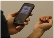 No bleeding required: Anemia detection via smartphone