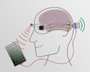 Sehbehinderte sollen durch Elektrostimulationen besser sehen
