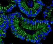 Wie das Immunsystem SARS-CoV-2 den Weg ebnet